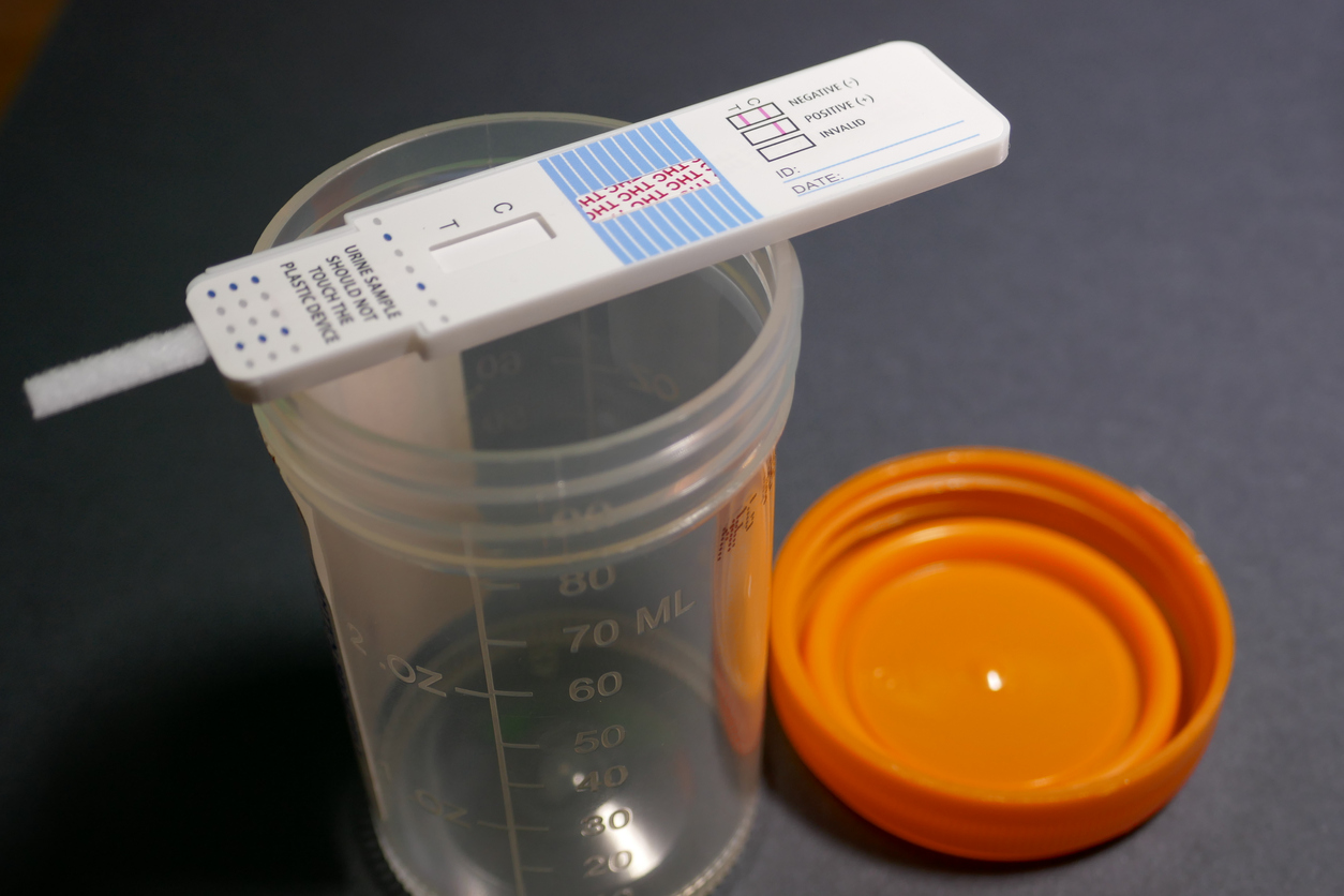 Employee Drug Tests in Ohio Found not to Violate Employee Privacy Thumbnail